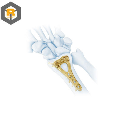 Muti-Axial Distal Radius Plam Locking Plate-II CNC Precision Machining Part for Benefit