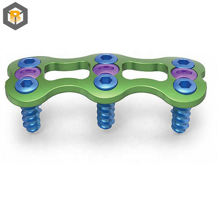 Customized by 2D/3D/Drawing Instruments Top Selling Orthopedic Implant Cortical Screw